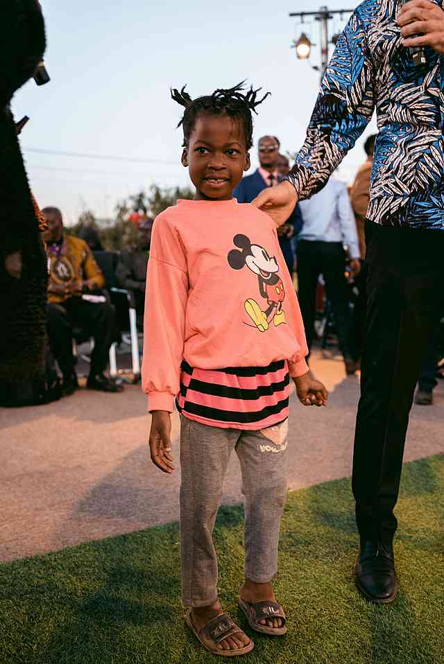 This little girl was born with a twisted and crooked leg This little girl was born with a twisted and crooked leg